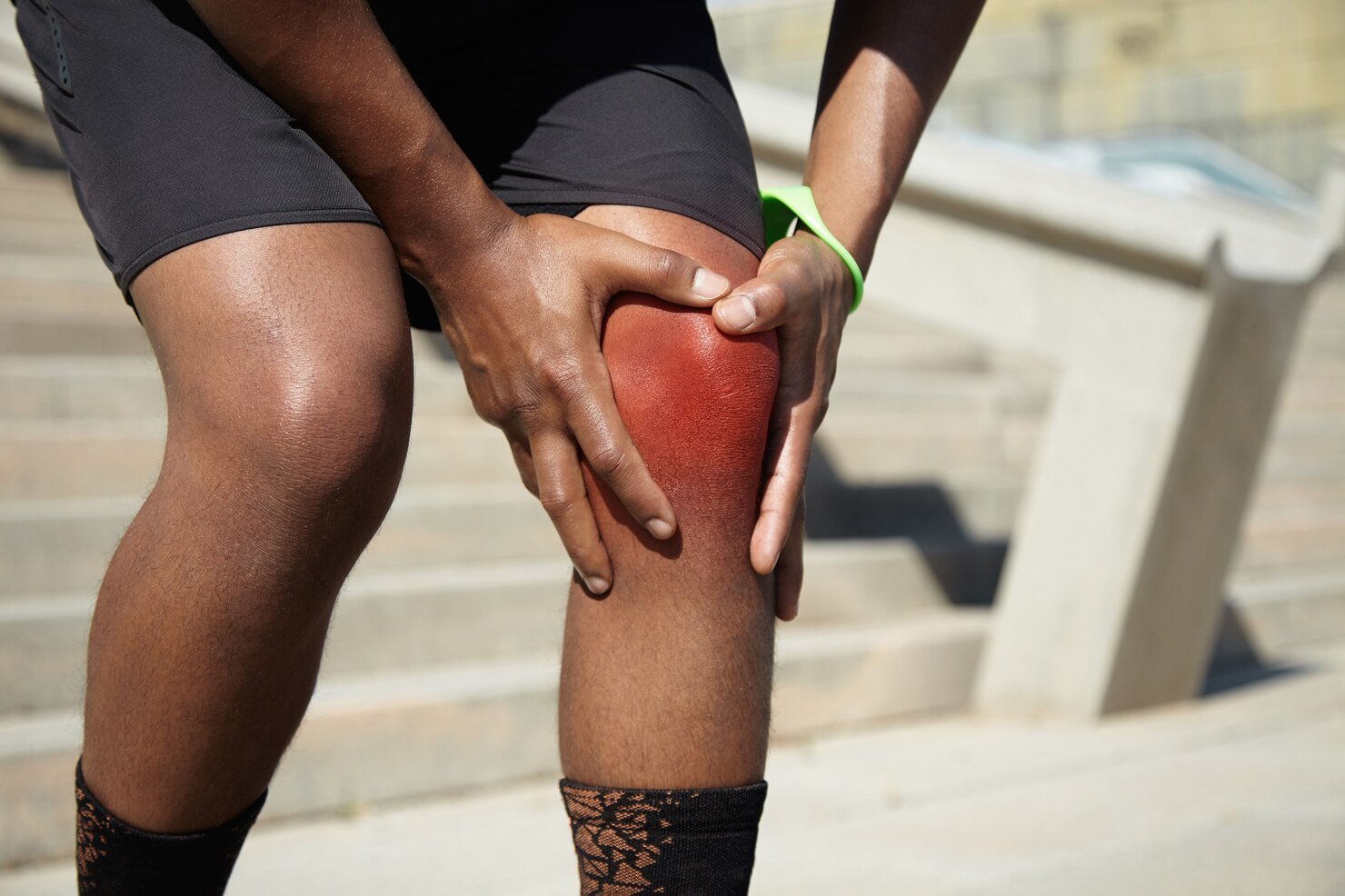 ACL Injury